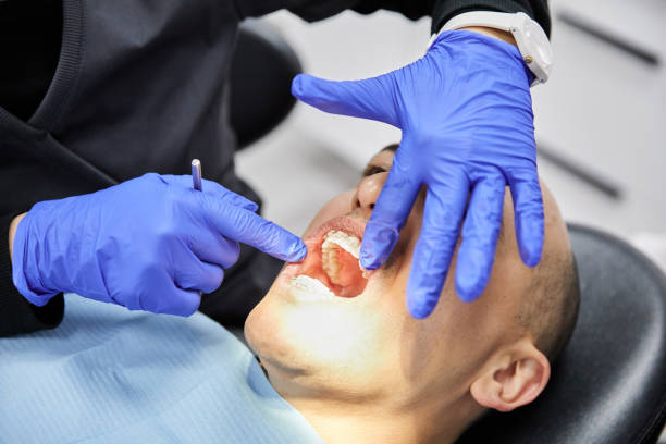 Best Emergency Wisdom Tooth Extraction in Nellieburg, MS